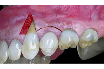 Odontopraxis Periodoncia 10