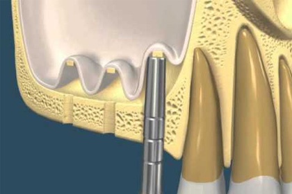 Odontopraxis Periodoncia 15