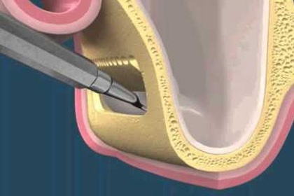 Odontopraxis Periodoncia 16