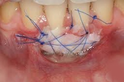 Odontopraxis Periodoncia 29