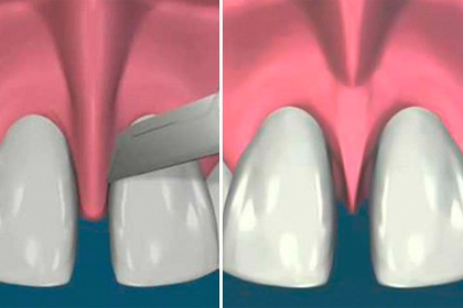 Odontopraxis Periodoncia 38