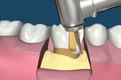 Odontopraxis Periodoncia 39